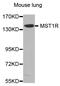 Macrophage Stimulating 1 Receptor antibody, MBS125830, MyBioSource, Western Blot image 