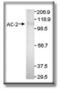 Adenylate Cyclase 2 antibody, PA1-31190, Invitrogen Antibodies, Western Blot image 
