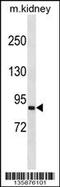 Semaphorin 4A antibody, 58-716, ProSci, Western Blot image 
