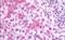 Wnt Family Member 10A antibody, NB100-59026, Novus Biologicals, Immunohistochemistry frozen image 