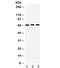 Potassium Voltage-Gated Channel Subfamily A Member 5 antibody, R32019, NSJ Bioreagents, Western Blot image 