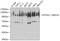 ATPase Sarcoplasmic/Endoplasmic Reticulum Ca2+ Transporting 2 antibody, GTX55790, GeneTex, Western Blot image 
