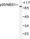 Nibrin antibody, LS-C176169, Lifespan Biosciences, Western Blot image 