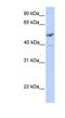 CMP-N-acetylneuraminate-beta-galactosamide-alpha-2,3-sialyltransferase 1 antibody, NBP1-62540, Novus Biologicals, Western Blot image 