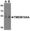 Transmembrane Protein 184A antibody, NBP1-77142, Novus Biologicals, Western Blot image 