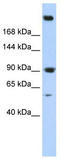 Spectrin Alpha, Non-Erythrocytic 1 antibody, TA344294, Origene, Western Blot image 