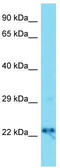 DnaJ Heat Shock Protein Family (Hsp40) Member C12 antibody, TA344721, Origene, Western Blot image 