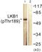 Serine/Threonine Kinase 11 antibody, PA5-38367, Invitrogen Antibodies, Western Blot image 