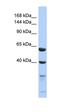 Testis Expressed 11 antibody, orb326076, Biorbyt, Western Blot image 
