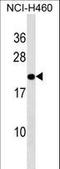 Transmembrane P24 Trafficking Protein 10 antibody, LS-C157209, Lifespan Biosciences, Western Blot image 