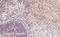 Integrin Subunit Alpha L antibody, GTX88390, GeneTex, Immunohistochemistry paraffin image 