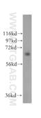 SUMO Specific Peptidase 3 antibody, 17659-1-AP, Proteintech Group, Western Blot image 