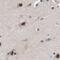 THO Complex 1 antibody, PA5-54056, Invitrogen Antibodies, Immunohistochemistry frozen image 