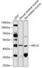 Mitochondrial Calcium Uptake 2 antibody, 14-309, ProSci, Western Blot image 