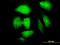 Necdin, MAGE Family Member antibody, LS-B6103, Lifespan Biosciences, Immunofluorescence image 