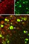 Sodium Voltage-Gated Channel Alpha Subunit 9 antibody, GTX54800, GeneTex, Immunohistochemistry frozen image 