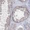 Erythrocyte Membrane Protein Band 4.1 Like 5 antibody, NBP2-30920, Novus Biologicals, Immunohistochemistry paraffin image 