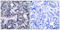Eukaryotic Translation Initiation Factor 2 Alpha Kinase 2 antibody, LS-C118226, Lifespan Biosciences, Immunohistochemistry paraffin image 