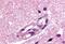 Apelin Receptor antibody, MBS244524, MyBioSource, Immunohistochemistry paraffin image 