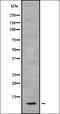 Small Nuclear RNA Activating Complex Polypeptide 5 antibody, orb337560, Biorbyt, Western Blot image 