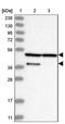 Inositol Polyphosphate-5-Phosphatase K antibody, NBP1-87034, Novus Biologicals, Western Blot image 