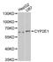 Cytochrome P450 Family 2 Subfamily E Member 1 antibody, A1342, ABclonal Technology, Western Blot image 