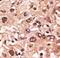 MAGE Family Member F1 antibody, LS-C100417, Lifespan Biosciences, Immunohistochemistry frozen image 