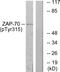 Zeta Chain Of T Cell Receptor Associated Protein Kinase 70 antibody, PA5-38350, Invitrogen Antibodies, Western Blot image 