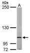 Eukaryotic translation initiation factor 4 gamma 2 antibody, GTX101710, GeneTex, Western Blot image 