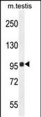 Transmembrane Protein 132E antibody, PA5-48214, Invitrogen Antibodies, Western Blot image 