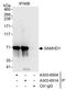 SAM And HD Domain Containing Deoxynucleoside Triphosphate Triphosphohydrolase 1 antibody, A303-691A, Bethyl Labs, Immunoprecipitation image 