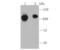 Nuclear Factor Kappa B Subunit 2 antibody, NBP2-66977, Novus Biologicals, Western Blot image 