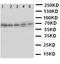 ATP Binding Cassette Subfamily G Member 5 antibody, LS-C313009, Lifespan Biosciences, Western Blot image 