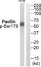 Paxillin antibody, 79-884, ProSci, Western Blot image 