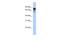 Dihydropyrimidinase Like 3 antibody, A05960, Boster Biological Technology, Western Blot image 