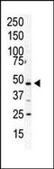 Phosphatidylinositol-5-Phosphate 4-Kinase Type 2 Alpha antibody, PA5-15286, Invitrogen Antibodies, Western Blot image 