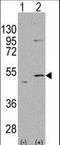 Aldehyde Dehydrogenase 5 Family Member A1 antibody, LS-B9002, Lifespan Biosciences, Western Blot image 