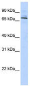 Tripartite Motif Containing 6 antibody, TA337276, Origene, Western Blot image 