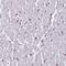 Karyopherin Subunit Alpha 3 antibody, NBP2-14172, Novus Biologicals, Immunohistochemistry paraffin image 