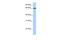 Zinc Finger Protein 417 antibody, A14800, Boster Biological Technology, Western Blot image 