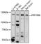 Protein Phosphatase 1 Regulatory Subunit 9B antibody, 16-889, ProSci, Western Blot image 