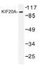 Kinesin Family Member 20A antibody, AP01361PU-N, Origene, Western Blot image 