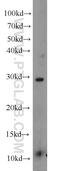 TCF3 Fusion Partner antibody, 10097-2-AP, Proteintech Group, Western Blot image 