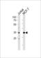 ATF4 antibody, LS-C156563, Lifespan Biosciences, Western Blot image 