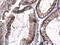 Fms Related Tyrosine Kinase 3 antibody, GTX101556, GeneTex, Immunohistochemistry paraffin image 