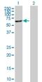 Alpha-1,3-Mannosyl-Glycoprotein 4-Beta-N-Acetylglucosaminyltransferase B antibody, H00011282-B01P, Novus Biologicals, Western Blot image 