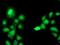 Complement C1s antibody, NBP2-01625, Novus Biologicals, Immunocytochemistry image 