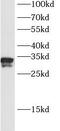 Kallikrein Related Peptidase 3 antibody, FNab04630, FineTest, Western Blot image 