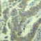 Myristoylated Alanine Rich Protein Kinase C Substrate antibody, AP0404, ABclonal Technology, Immunohistochemistry paraffin image 