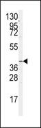 G Protein Subunit Alpha 12 antibody, PA5-15279, Invitrogen Antibodies, Western Blot image 